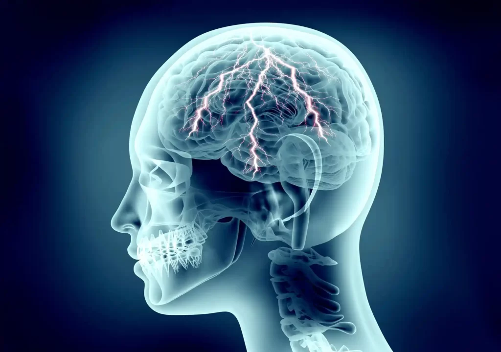 illustration av hjärnan med elektriska stötar